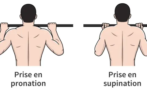 Comparaison de la prise en pronation et de la prise en supination pour un exercice de traction.